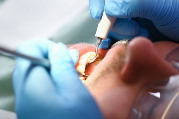 Best Mobile Emergency Dentist in Bexley, OH