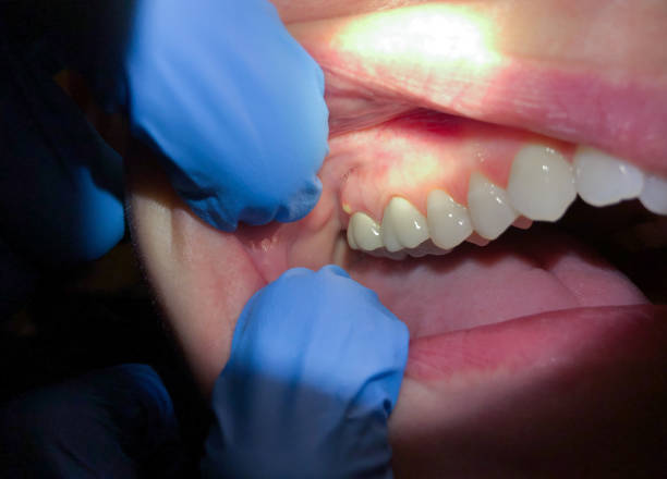 Best Pediatric Emergency Dentist in Bexley, OH