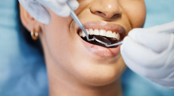 Best Holiday Emergency Dentist in Bexley, OH